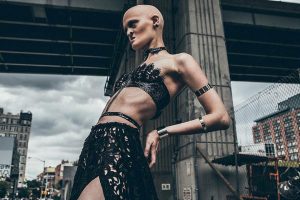 Conocé a la modelo que tiene una mutación genética única