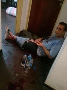 Brutal: mujer le cortó el pene y los testículos a su pololo con tijera podadora
