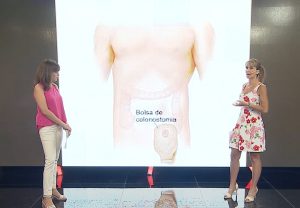 ¿Cómo se puede mejorar la vida de los pacientes ostomizados?