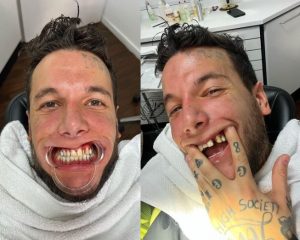 "Tabas con la Ricarda": Alex Caniggia mostró sus dientes pero dejó entrever otra cosa y en las redes lo destruyeron