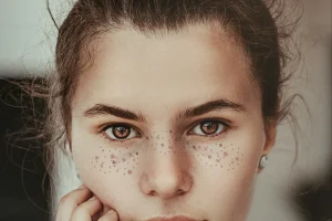 Pecas, ¿cómo lucirlas naturalmente o crearlas con make up?