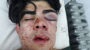 Detuvieron a cinco personas por la golpiza al joven con acento chileno