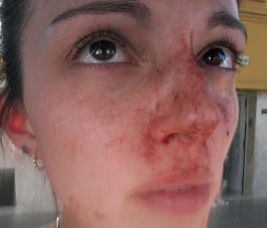 Video: Una joven mostró cómo su ex la golpeó en plena calle