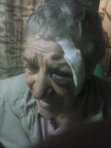 San Martín: Golpearon ferozmente a un abuelo y le robaron sus ahorros