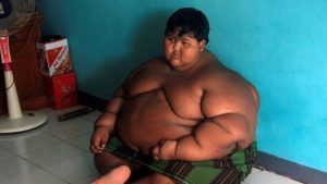 Video: La increíble transformación del niño más obeso del mundo