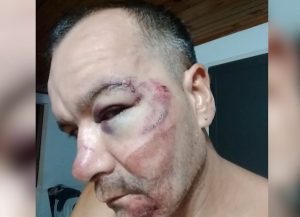 Ciclismo: pelea y violenta caída en el campeonato mendocino