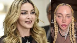 Preocupación por Madonna: ¿Qué le pasa a la reina del pop?