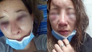 Violencia extrema en Chaco: golpearon a una mujer hasta desfigurarle el rostro y le arrancaron las uñas