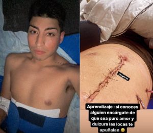 Una chica apuñaló a su novio a la salida de un boliche por celos