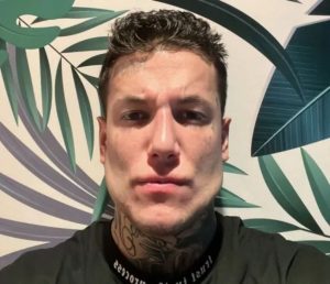 "La mandíbula del emperador, te re cabió Brad Pitt": Alex Caniggia se operó la cara y sorprendió a todos