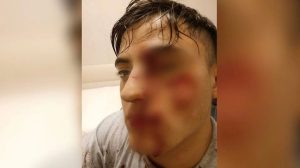 "Si Dios me devuelve la vista, a este pibe lo perdono”: perdió un ojo el joven agredido en un boliche