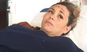 “Me hice la muerta para que no me maten”: le dispararon en la cabeza durante un asalto